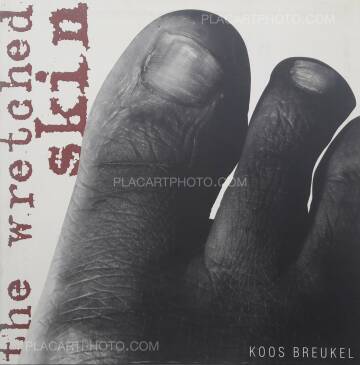 Koos Breukel,The Wretched skin (DEDICATED) Koos Breukel,The Wretched skin (DEDICATED)