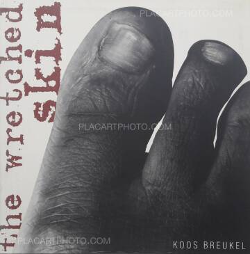 Koos Breukel,The Wretched skin (DEDICATED)