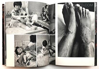 Ken Domon,Hiroshima (Signed) Ken Domon,Hiroshima (Signed)