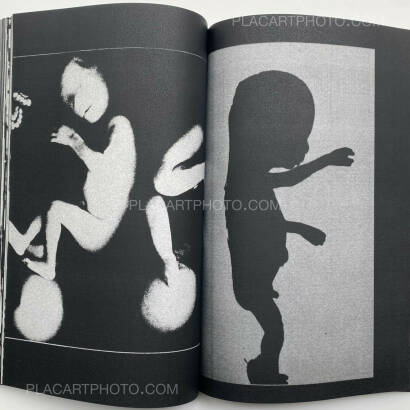 Collective,LIVE MATCH (Complete set of 3, signed and numbered of only 50) Collective,LIVE MATCH (Complete set of 3, signed and numbered of only 50)